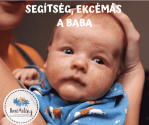 ekcéma baba